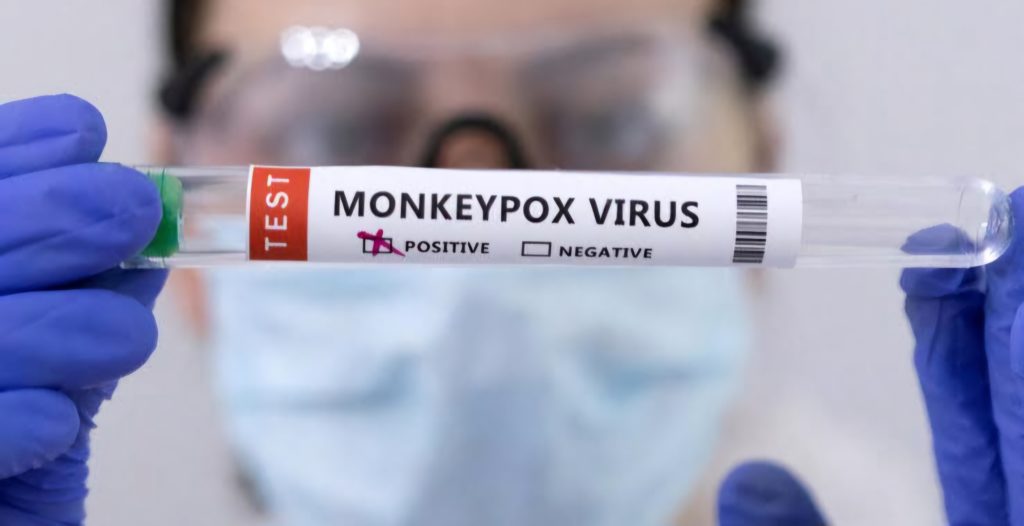Cas de Monkeypox en Algérie: L'ANSS réagit!