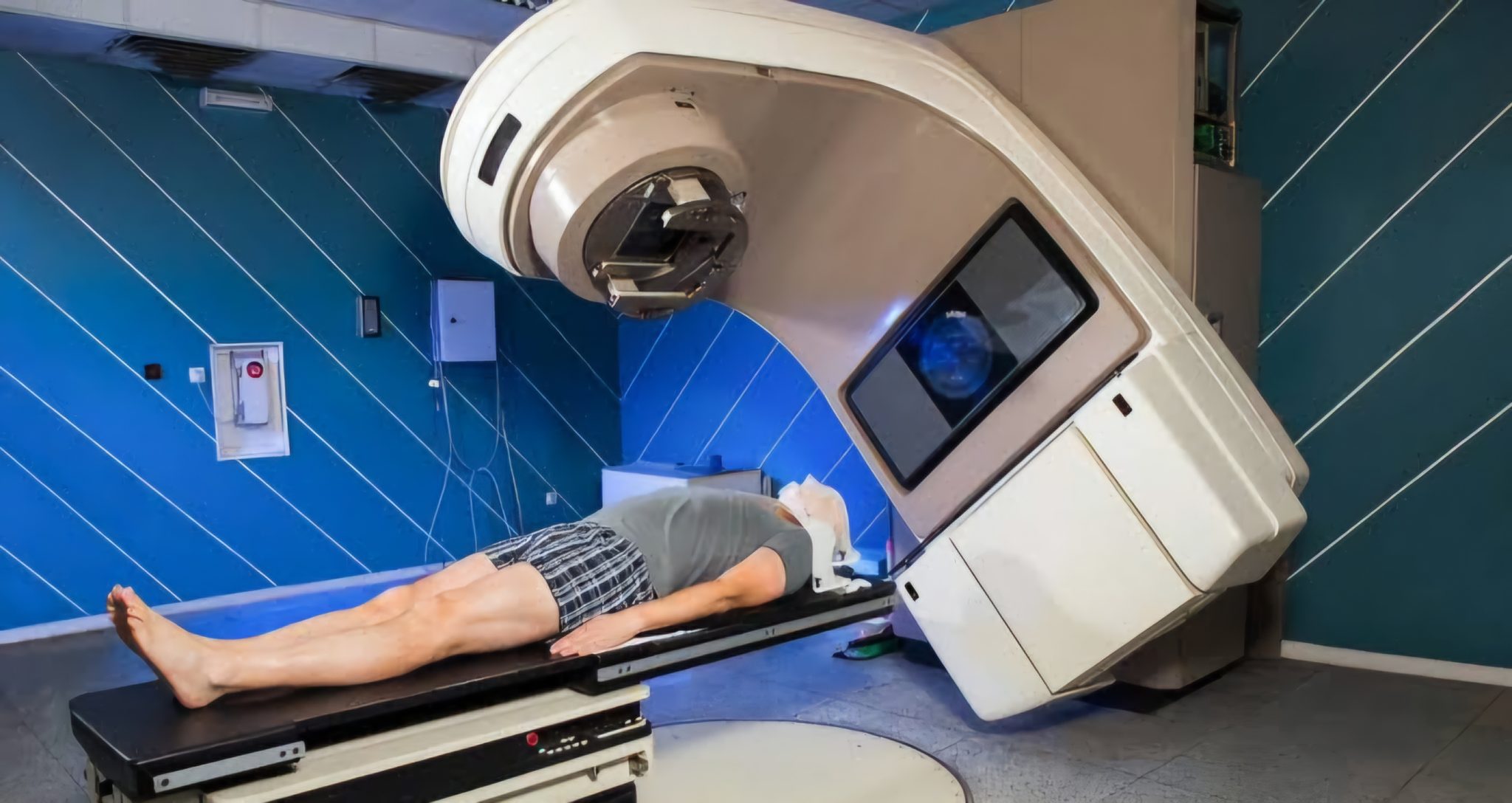 Cancer de la prostate: Une radiothérapie «surpuissante» à l'étude